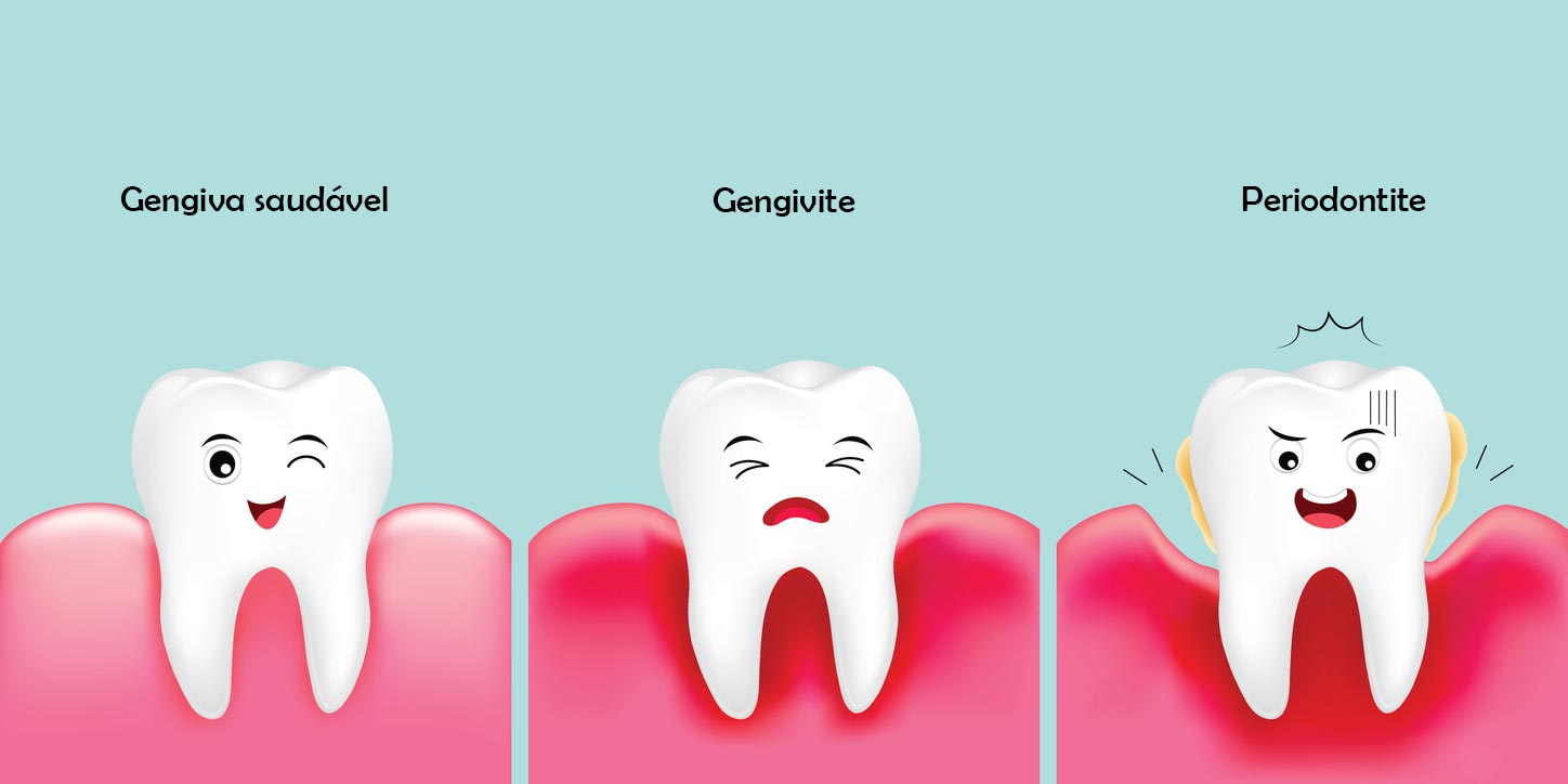 Como Tratar Doen As Que Afetam A Gengiva