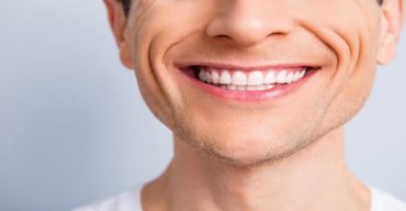 Na imagem é possível ver um rapaz de sorriso largo, com os benefícios do clareamento dental