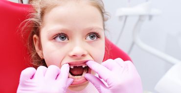 criança com a boca aberta e mão do dentista mostrando as curiosidades sobre os dentes de leite