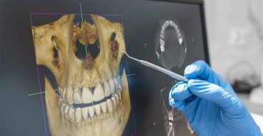 imagem de raio x e dentista verificando por meio da radiografia digital